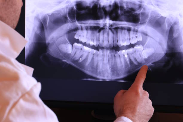 Best Emergency Dentist for Lost Fillings or Crowns in Marlin, TX