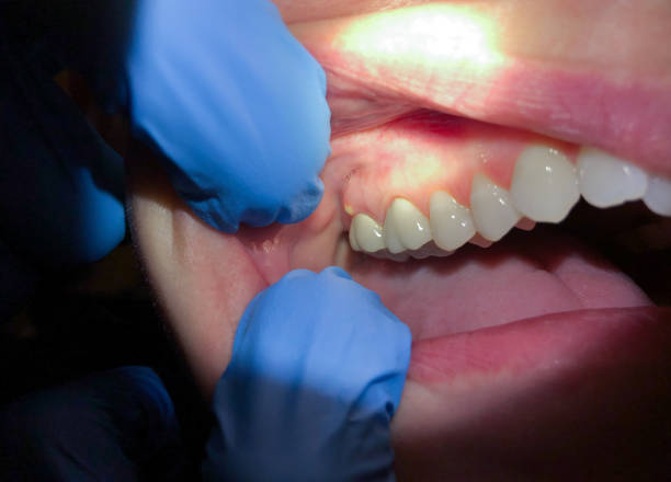 Best Orthodontic Emergency Dentist in Marlin, TX